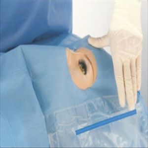 Surgical Ophthalmological Fenestrated Drapes Disposable SBPP PE Material