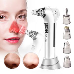 Top Beauty Electric Hot And Cold Blackhead Removal Facial Pore Acne Skin Care