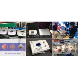 High Frequency Professional Vascular Removal Machine Spider Vein Removal Machine