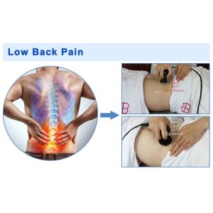 Smart Tecar Therapy Machine Body Rehabilitation Diathermy Physical Capacitive