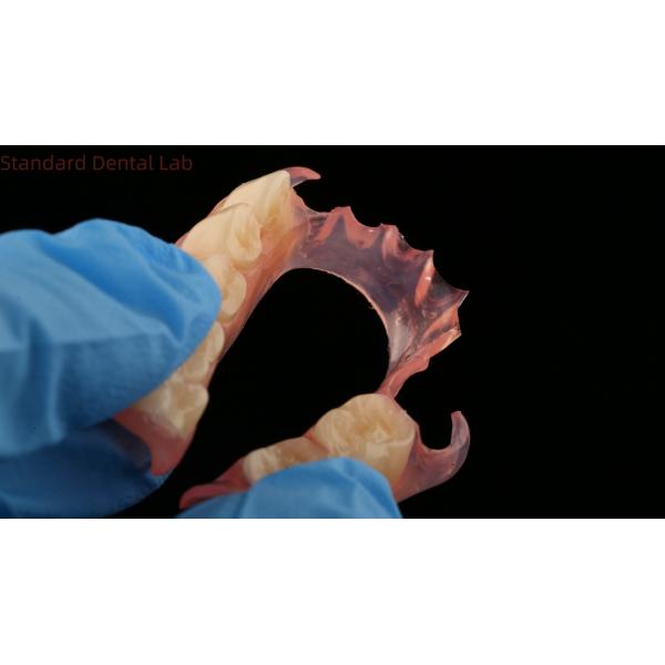 Dental TCS Valplast Flexible Partial Dentures Dental Lab 3D Print Model High Esthetics