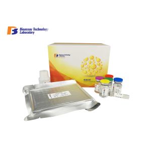 Quality ELISA Kit for Human High Sensitivity and Specificity AD for sale