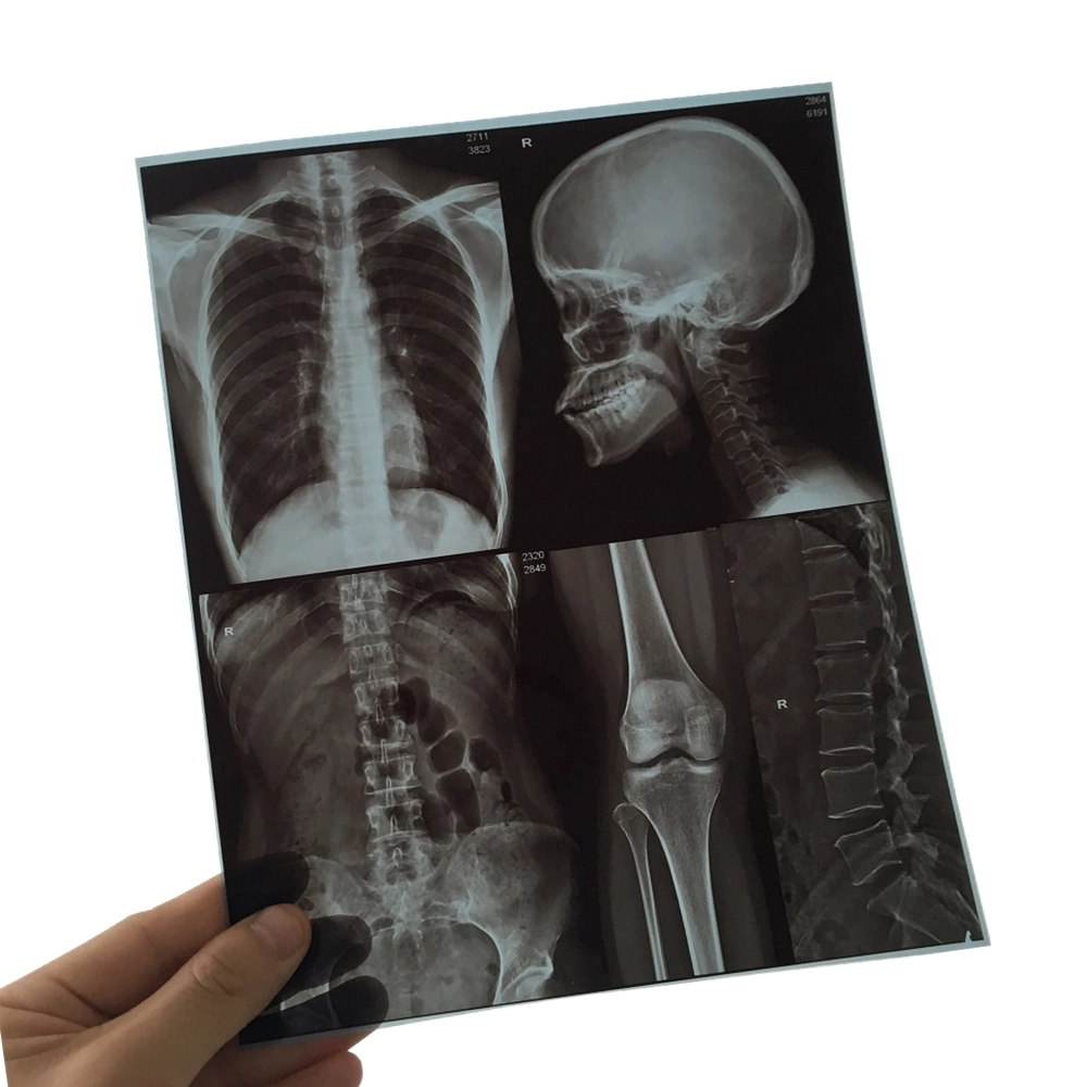Blue Color 10X12 Inch Inkjet Pet Medical X-ray Film/Image