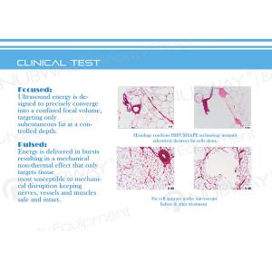 LEADBEAUTY New Arrival !!! Most Advanced HIFU Slimming Machine