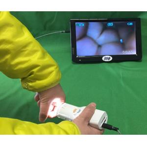 Self - Inspection Tool for Cervical Examination Digital Electronic Colposcope