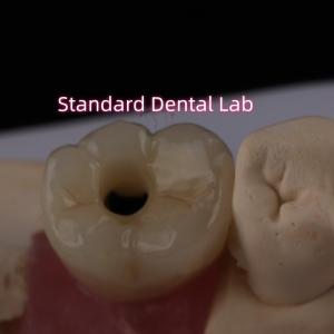 China Posterior Implant Crown Bruxier Solid Zirconia Screw Retained on sale