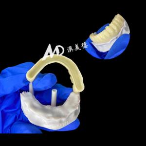 PMMA Provisional Implant Bridge Hollow Inside Ensuring Stability and Natural