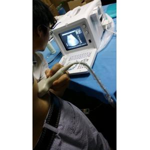 CLS-2180 Portable Ultrasound Scanner
