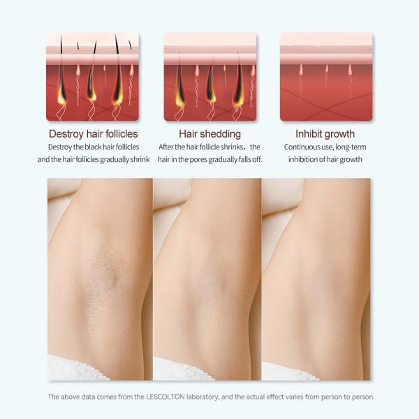 IPL Hair Removal with Ice Cooling System, Permanent Hair Removal Upgraded to 400,000 Flashes Device for Women and Men