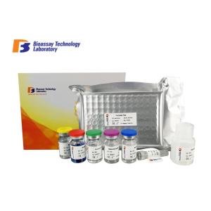 China Professional Ps Human Elisa Kit Customized Accurate Quantitative Detection on sale