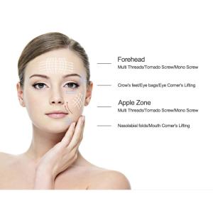 Vigor koreabulk pdo threads tension threads cog molding tension threads face