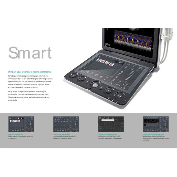 Sonoscape S9 Pregnant Baby Medical Diagnosis 4D Color Doppler Sonography Machine Portable Ultrasound