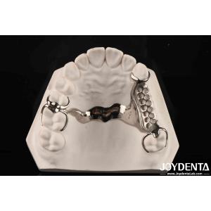 Clinical Practice Dental Alloying Metal Framework Good Fit In The Mouth