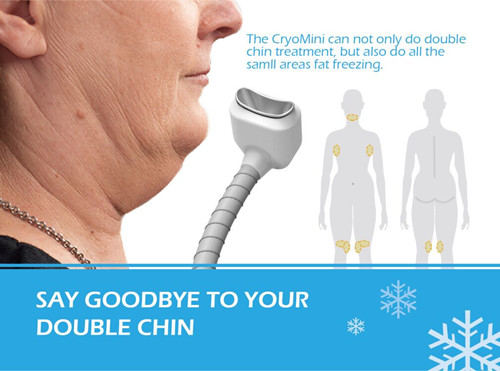 Beautiful Design High Quality Manufacturer Direct Sale Portable Cryolipolysis Machine For