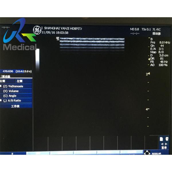 GE 7L-RC 12MHz Wide Band Linearx Used Ultrasound Probe Medical Hospital