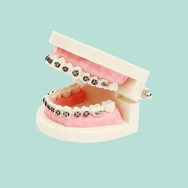 Porcelain Dental Crown Acid And Alkali Resistance Good Biocompatibility