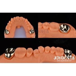Dental Restoration Gold Metal Crowns for Oral Rehabilitation Treatment