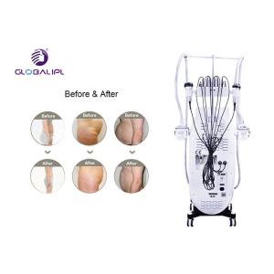 Cryotherapy Fat Reduction Equipment / Body Slimming Machine With Ce Approval