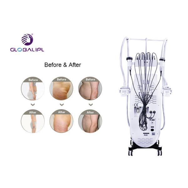 Cryotherapy Fat Reduction Equipment / Body Slimming Machine With Ce Approval
