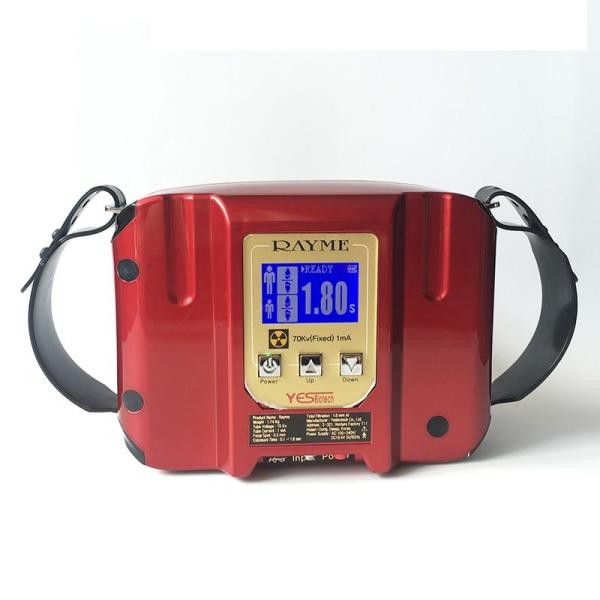 70Kv Rayme Imaging Digital Portable Wireless Dental X-ray Machine