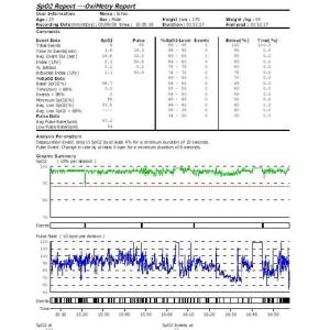 Infant Convenient Overnight Fingertip Pulse Oximeters with Alarm AH - 50E