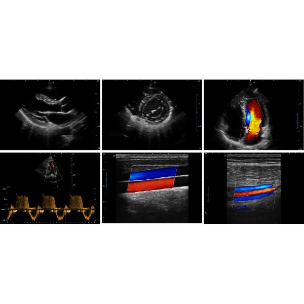 Sonoscape X5 Medical Ultrasound Instruments Machine with Excellent Image Quality