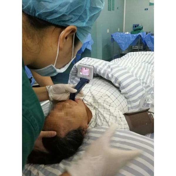 PC Material Macintosh Blade Laryngoscope Glottis Visible Video Intubation