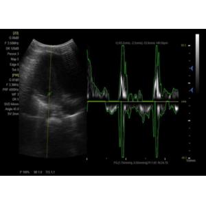 Panoramic Focusing Color Doppler Machine With 4D Function Optional