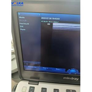 Mindray Laptop Original Ultrasound System M9 Curved array