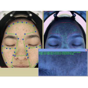 Moisture Analyzer Face Camera 20Mega Pixels FCC Certificate