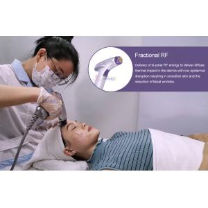 Rf Fractional Microneedle Rf Face Lifting Anti Wrinkle Machine