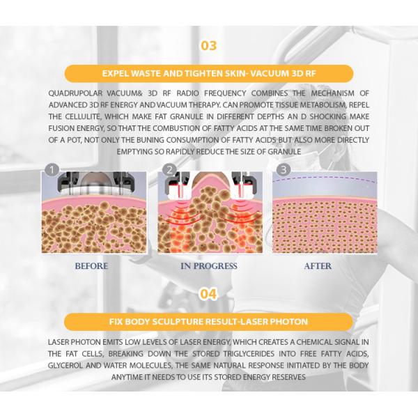 7 In 1 Vacuum Cavitation Machine Body Slimming RF Laser Beauty Instrument