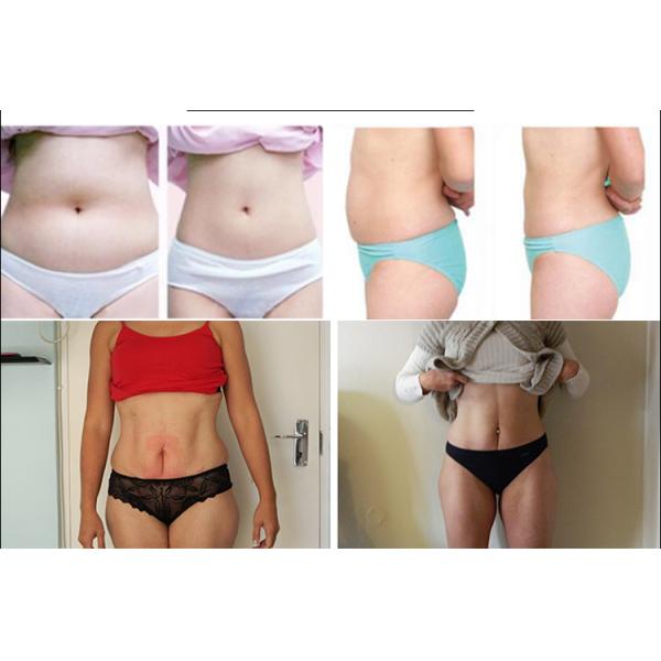 Beauty Salon Cryolipolysis Machine Slimming Body Lose Weight Machine 660W