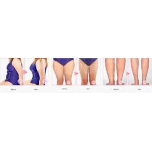 Portable No Needles Mesotharapy needle free beauty equipment machine