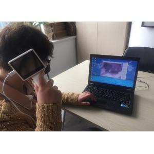 China Wifi Connection Digital Mini Handheld Otoscope Laryngoscope Rhinoscope Camera With 3.5 Inch LED Monitor on sale