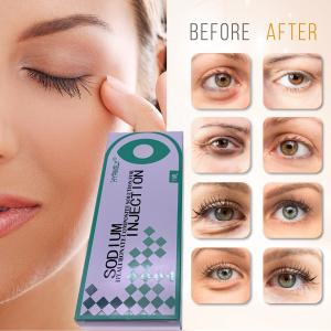 Hyamely Removing Dark Circles Injection Filling Tear Troughs 1ml