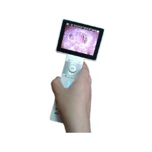 1920x1080 Digital Video Dermatoscope