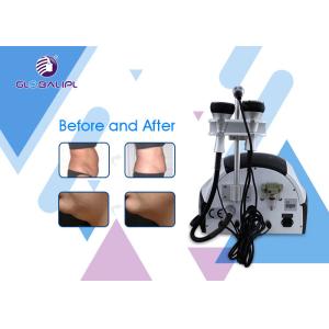 40KHz Body Slimming Machine Ultrasonic RF Vacuum Cavitation Machine