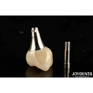 China Biocompatible Dental Implant Crown And Bridge Aesthetically Pleasing For Safe Oral on sale