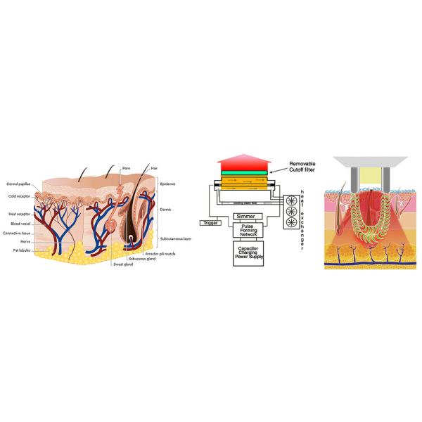 No Pain Ipl Beauty Machine LCD Color Screen For Facial Rejuvenation