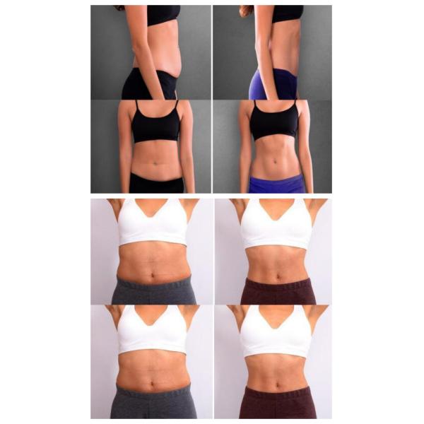 Hiemt Ems Body Contouring Machine For Cellulite Reduction