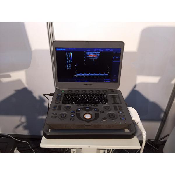 Sonoscape X5 Medical Ultrasound Instruments Machine with Excellent Image Quality