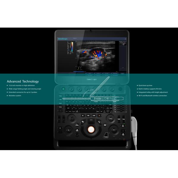 Sonoscape X5 Medical Ultrasound Instruments Machine with Excellent Image Quality