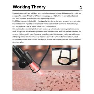 Fractional CO2 Laser Scar Therapy Removal Skin Rejuvenation Resurfacing Laser