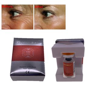 Anti Aging Hyamely Injections For Face Wrinkles
