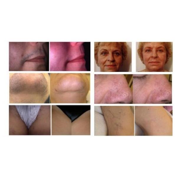 White Hair Removal Multifunction Beauty Machine Skin Rejuvenation 4 in 1 facial machine