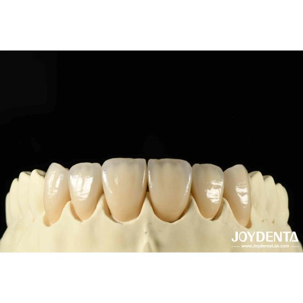 Buy Bionic Development Leaves And Distinct Layers Of Zirconia All-Ceramic at wholesale prices