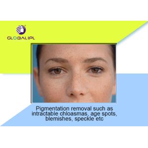 50W Skin Resurfacing CO2 Fractional Laser Machine Fractional Photothermolysis