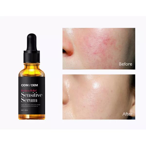 ODM Redness Remover Essence Face Serum For Dry Sensitive Skin