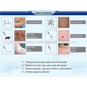 30hz high frequency Immediately result 8.4Inch touching screen spider vein